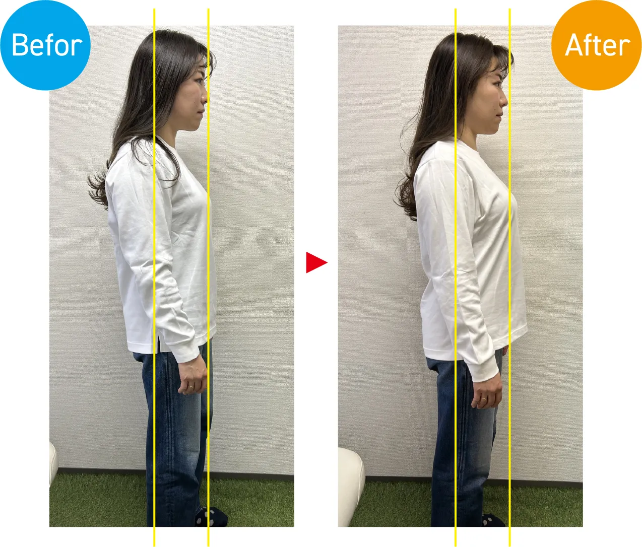 小顔整体 施術前後の比較（全身）
