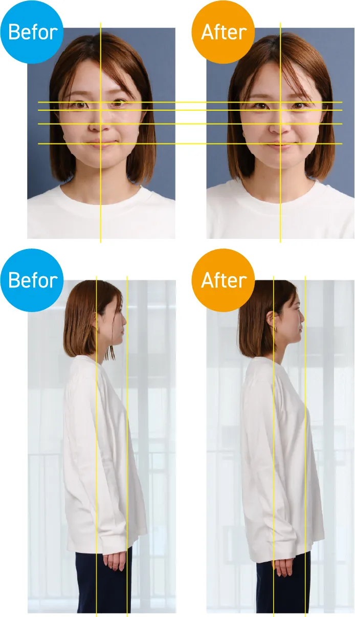 施術前後の比較